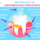 sintomas enfermedades periodontales, infografia