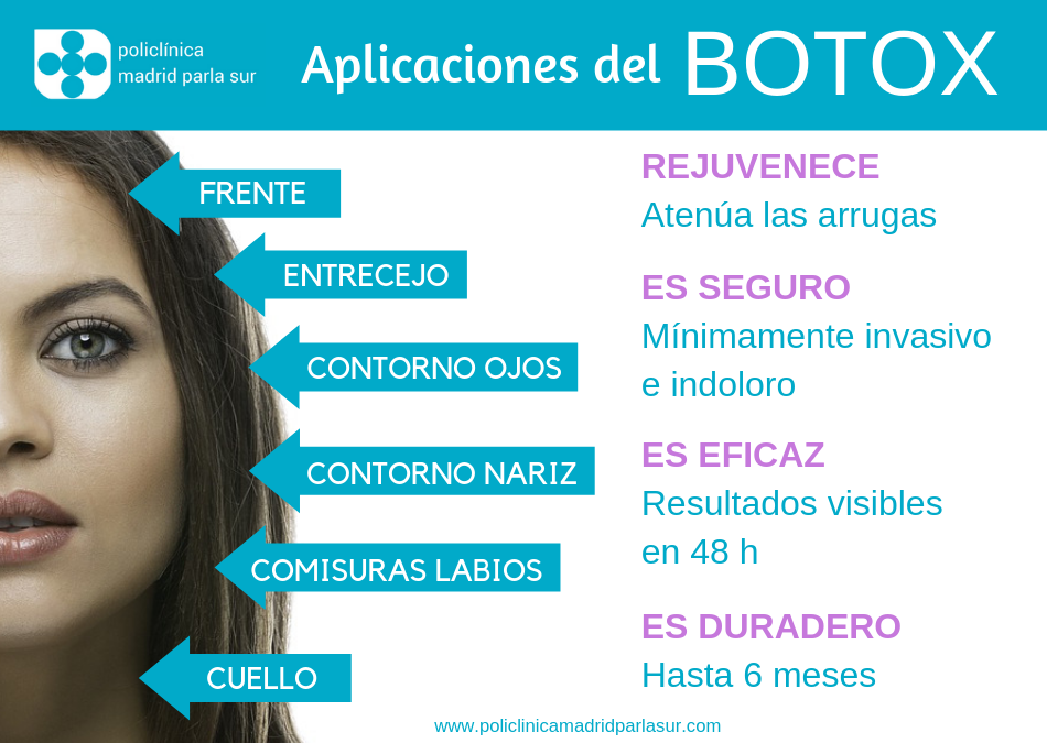 estetica parla aplicaciones botox infografia