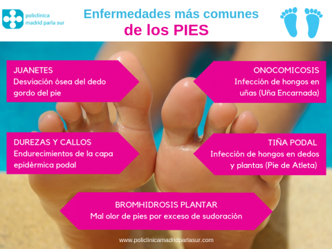 Podologo Parla: Problemas más comunes de los pies - Infografía
