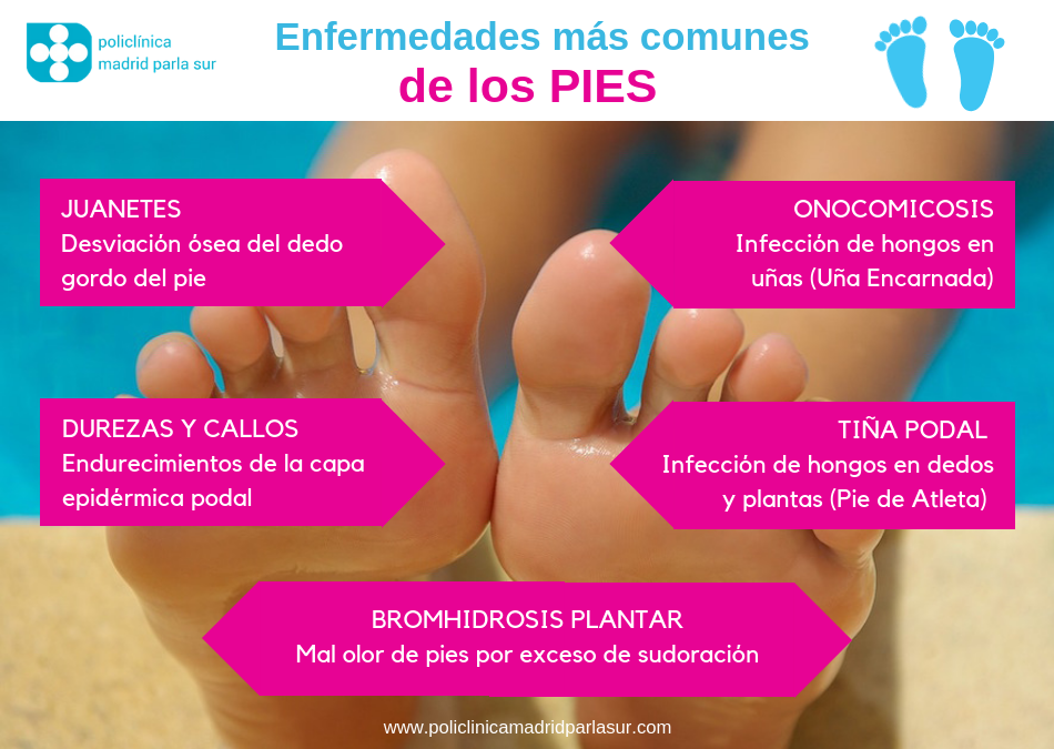 Podologo Parla: Problemas más comunes de los pies - Infografía