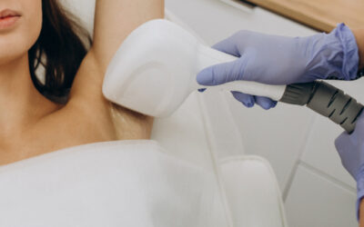 La depilación láser